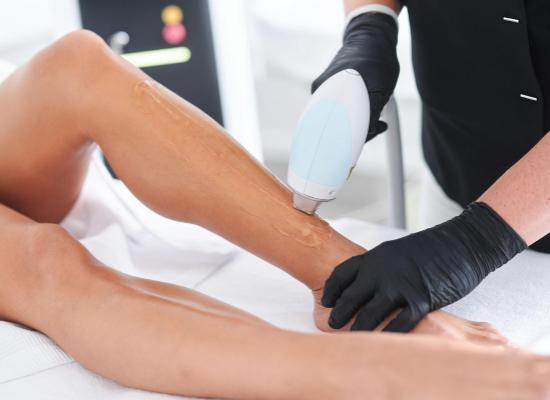 Diode laserontharing: geavanceerde technologie voor langdurige resultaten