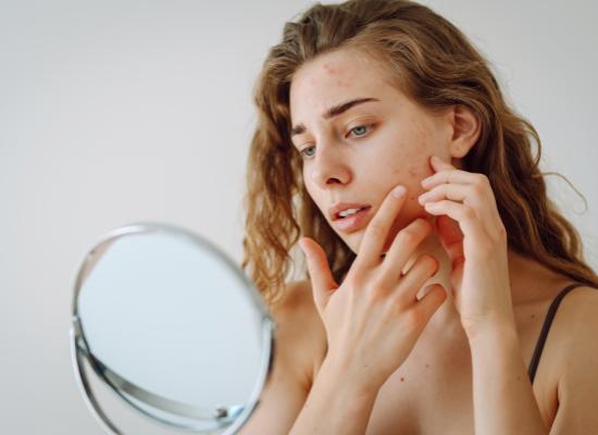  Skincaresangst: een groeiend probleem onder jongeren